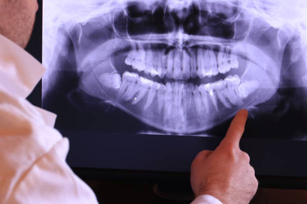 Best Emergency Root Canal Therapy in North Richmond, CA