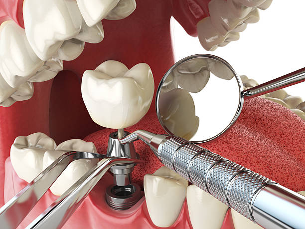 Best Emergency Dental Care for Sports Injuries in North Richmond, CA